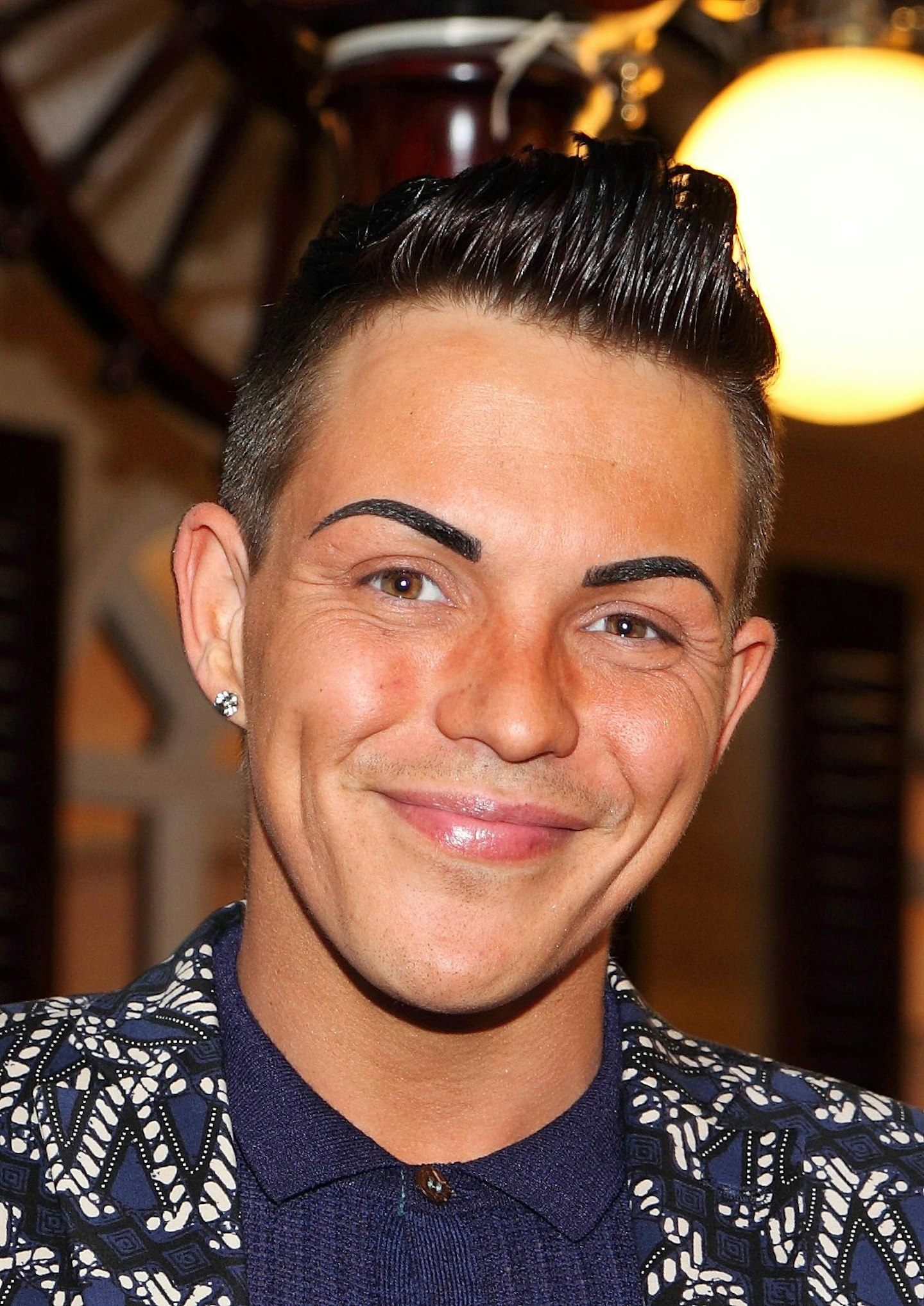 Bobby Norris lip job