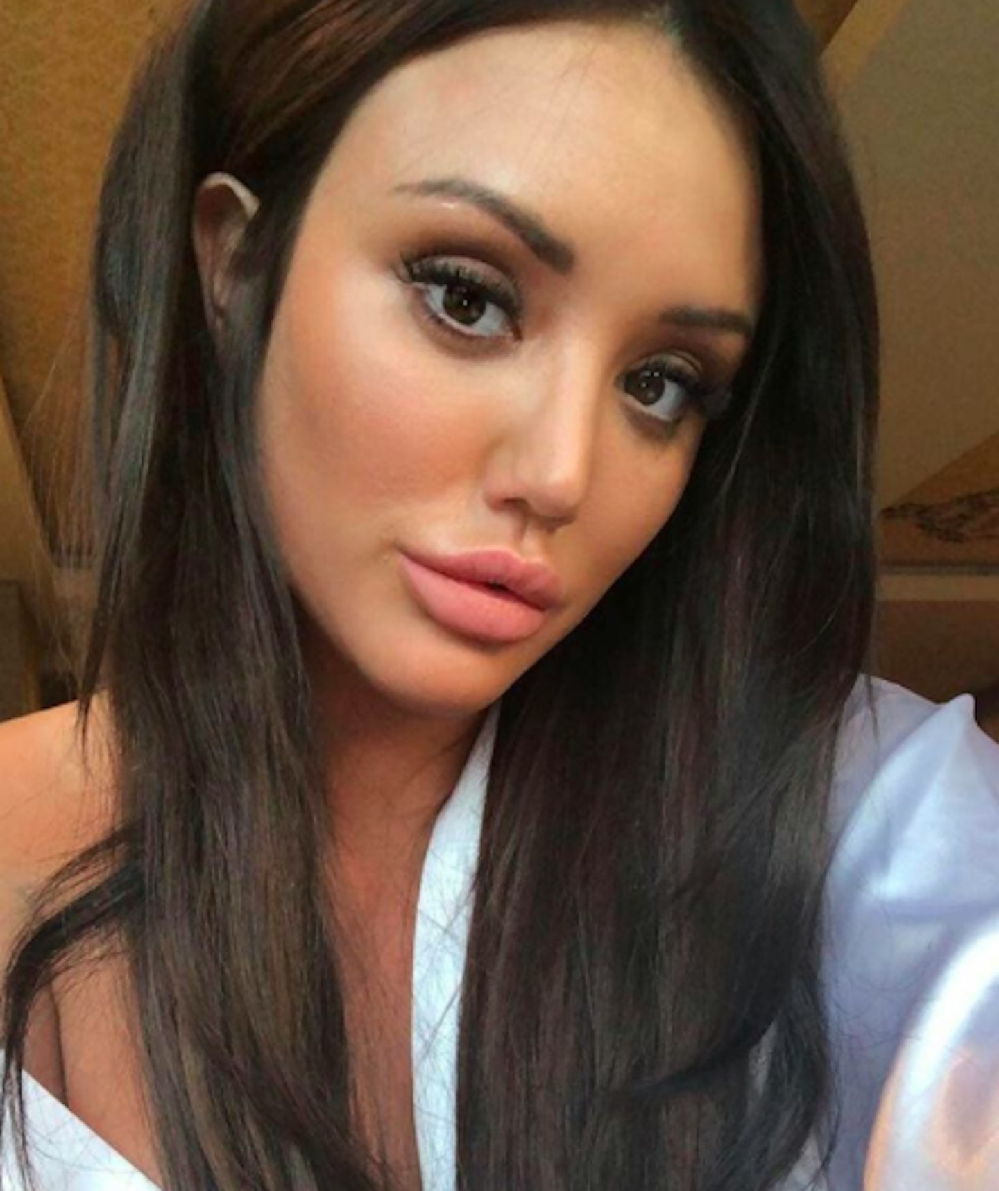 Charlotte Crosby lip job
