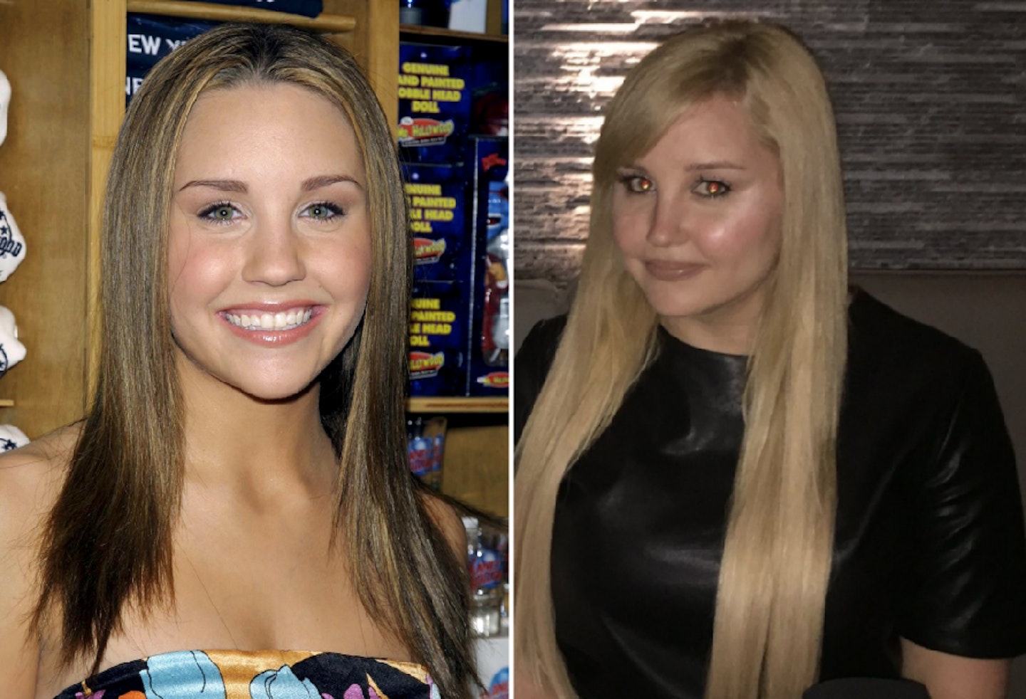 Amanda Bynes before and after plastic surgery